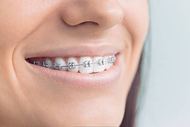 Best Invisalign and Clear Aligners  in Socorro, TX